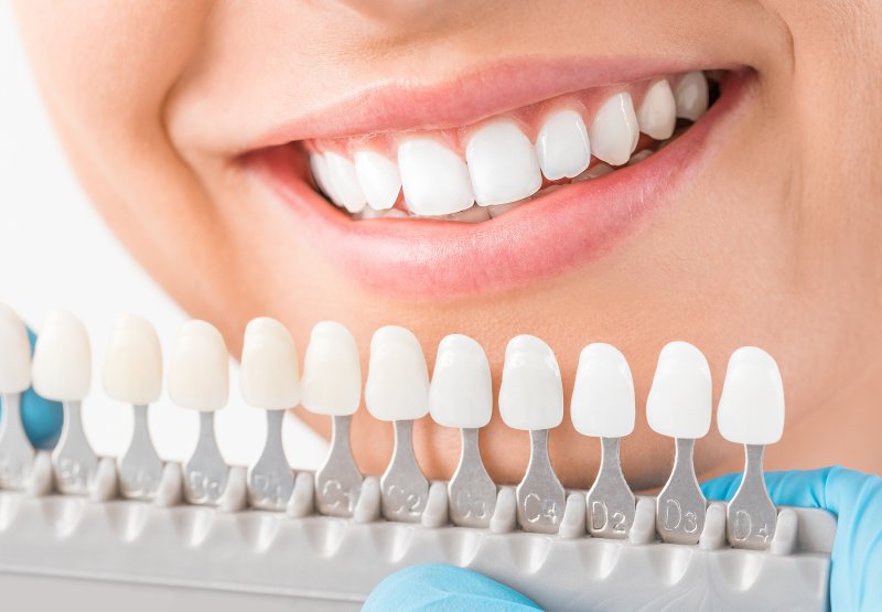 Restore Your Smile with a Dental Crown in Hackettstown!